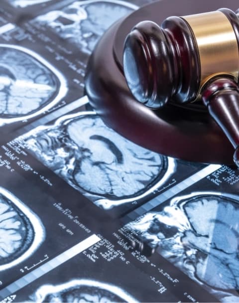 모바일, 테블릿에서 노출되는 section1 의료사진 판사봉 이미지